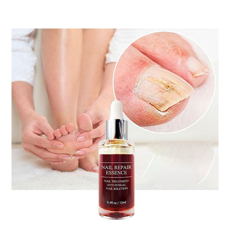 Nail Repair Oil_0005_img_1_Herbal_Nail_Fungus_Treatment_Nail_Care_T.jpg