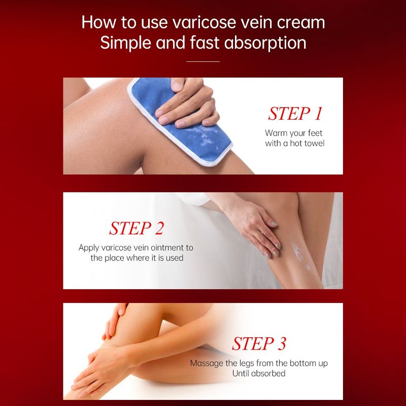 Varicose Veins Relief Cream12.jpg