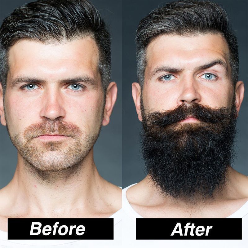 Beard Growth Kit1.jpg
