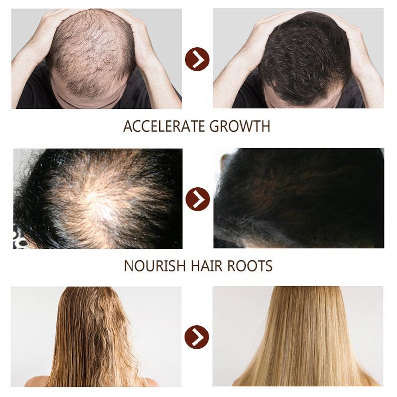 Hair Growth Oil_0002_Layer 2.jpg