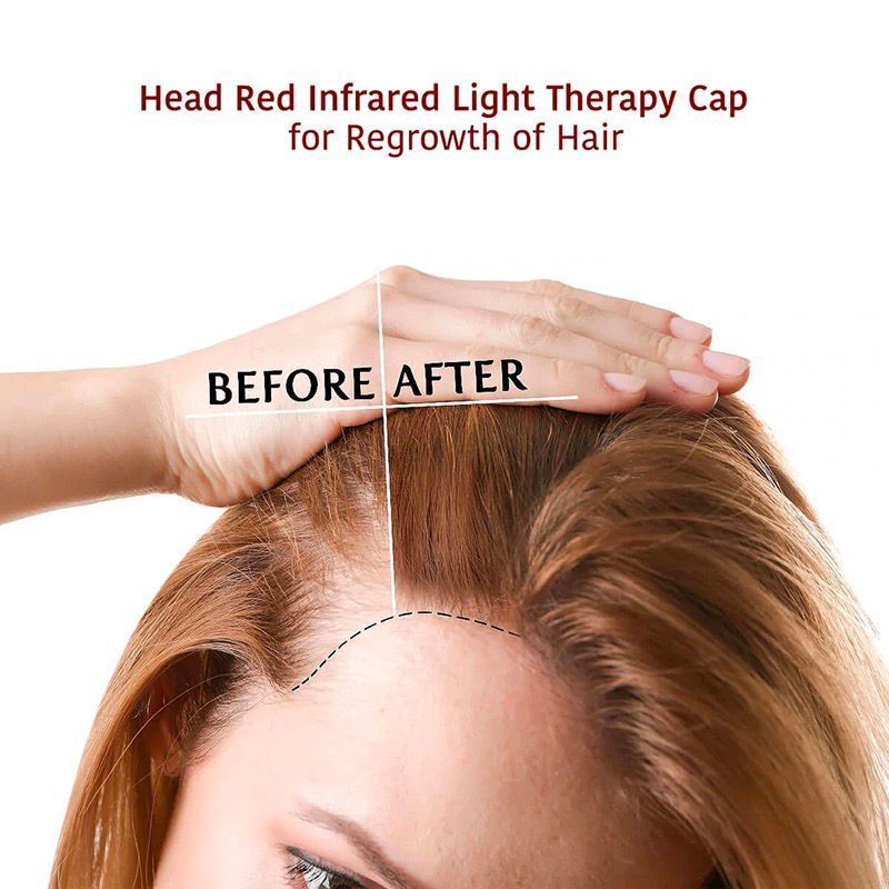 Hair Regrowth LED light therapy15.jpg