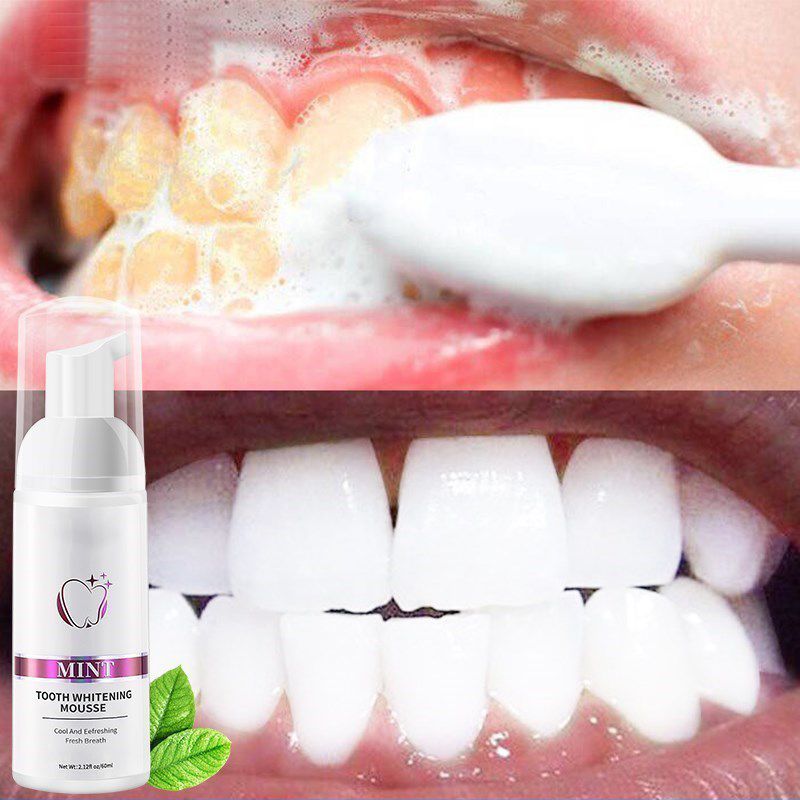 Teeth Cleansing Whitening Mousse1.jpg
