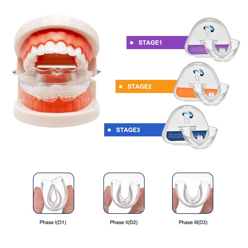 3Pcs invisible braces4.jpg