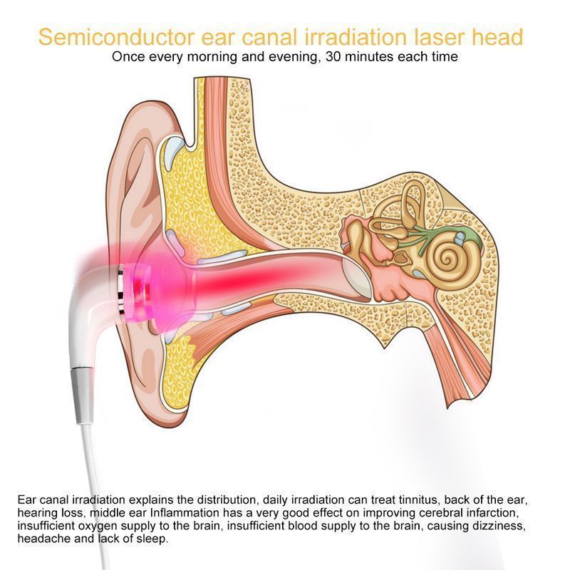 Tinnitus Ear Laser Therapy9.jpg